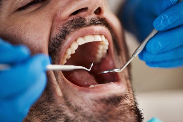 Best Emergency Dental Surgery in Waverly, IL